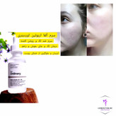 سرم آلفا آربوتین ۲٪ + هیالورونیک اسید اوردینری، مناسب برای کاهش لک و آبرسانی پوست
