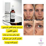 سرم دور چشم ضد تیرگی و پف کافئین اوردینری، مناسب برای کاهش پف و روشنکردن پوست دور چشم